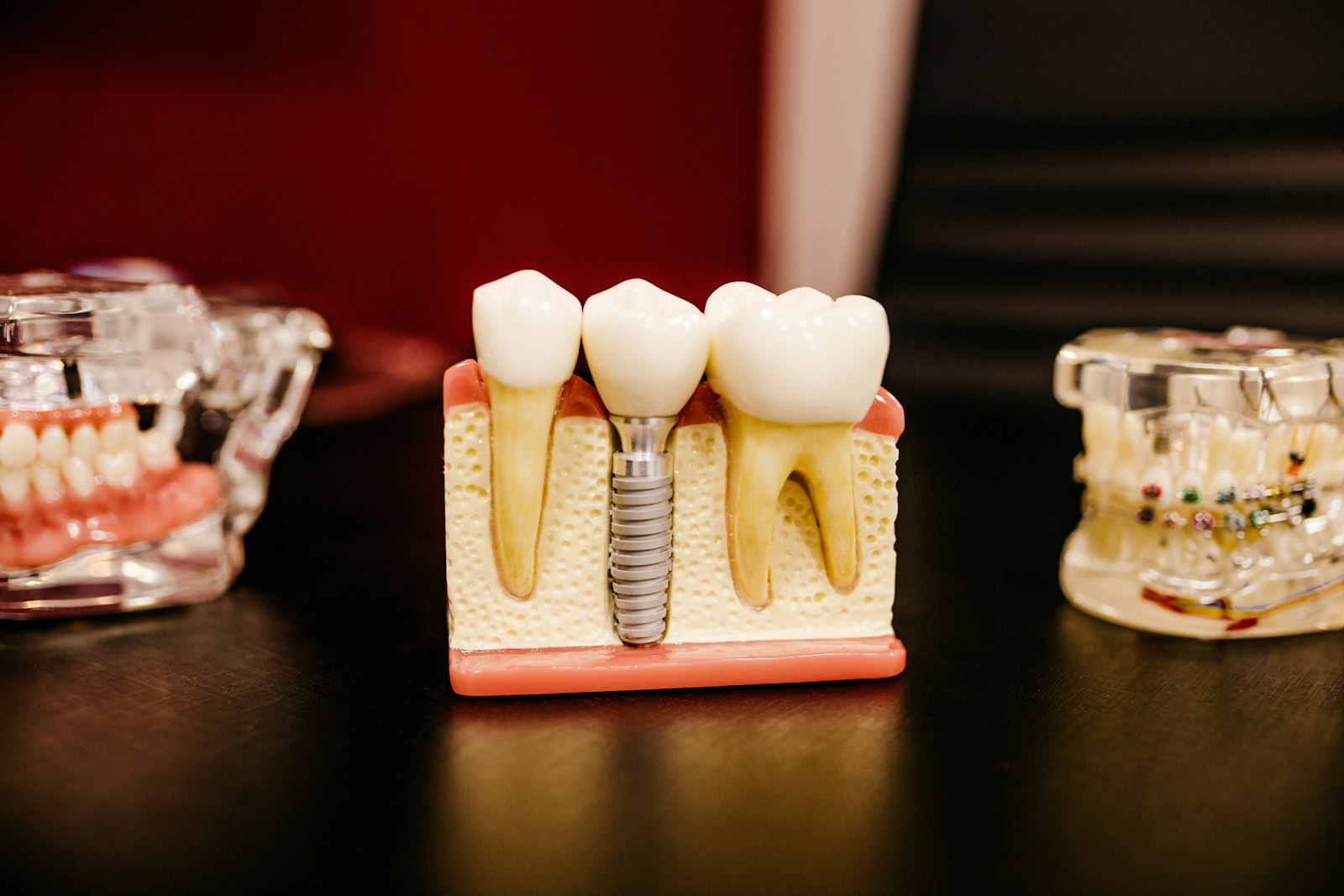 A dental study model used for planning restorative work